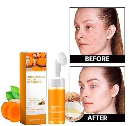 Turmeric ππ¨π£π’π Face Wash, Natural (Pack of - 2 ) 150 ML