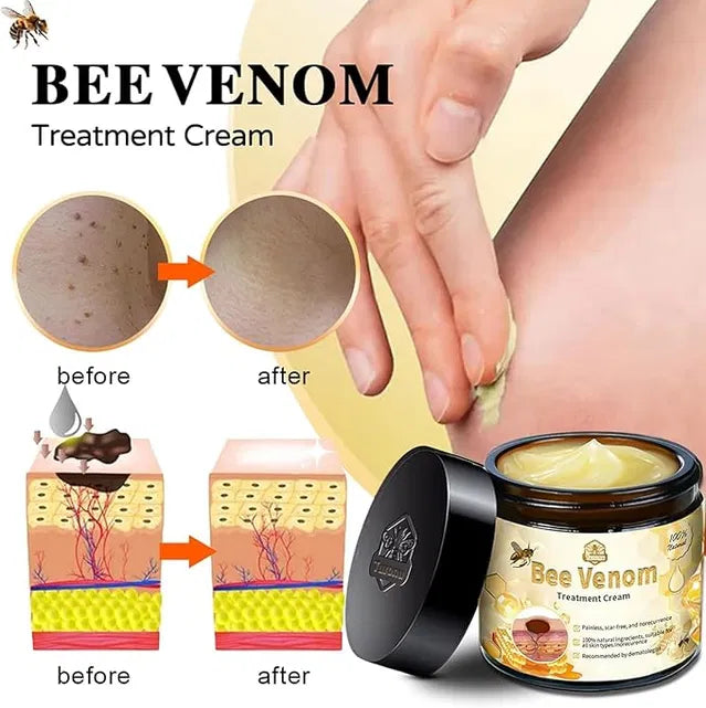 Bee Venom Skin Treatment Cream,Repair Maximum Strength for All Skin Types (2PCS)